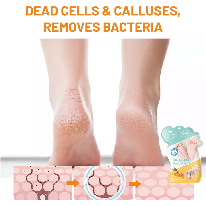 Aichun Beauty Peeling Foot Mask (1 Pair) – Turmeric & Honey